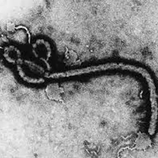 The Deadly Guanarito Virus : Understanding Venezuelan Hemorrhagic Fever